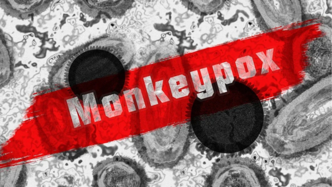 Monkeypox atau cacar monyet