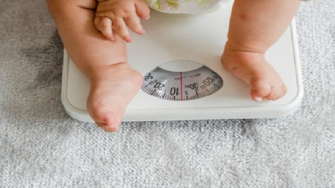 Faktor Genetik jadi Pemicu Balita Obesitas di Bekasi